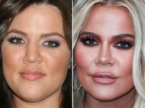 khloe hart before and after.